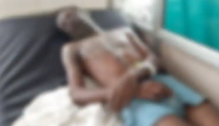 पहले तेजाब को उबाला, ज्यादा तकलीफ हो इसके लिए उसमें डाली लाल मिर्ची... पत्नी ने पति पर किया Acid attack