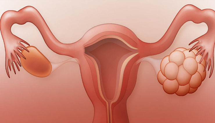 periods,missed your periods,reasons missed your periods,menstruation,uterus,women health,Health tips