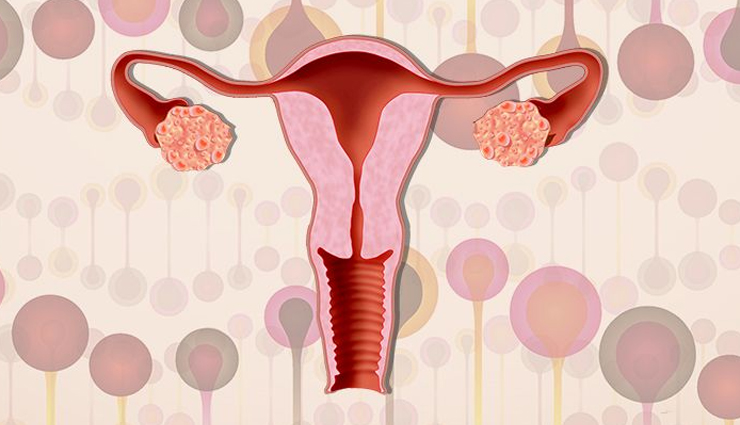 5 Ayurvedic Herbs That are Effective for PCOS