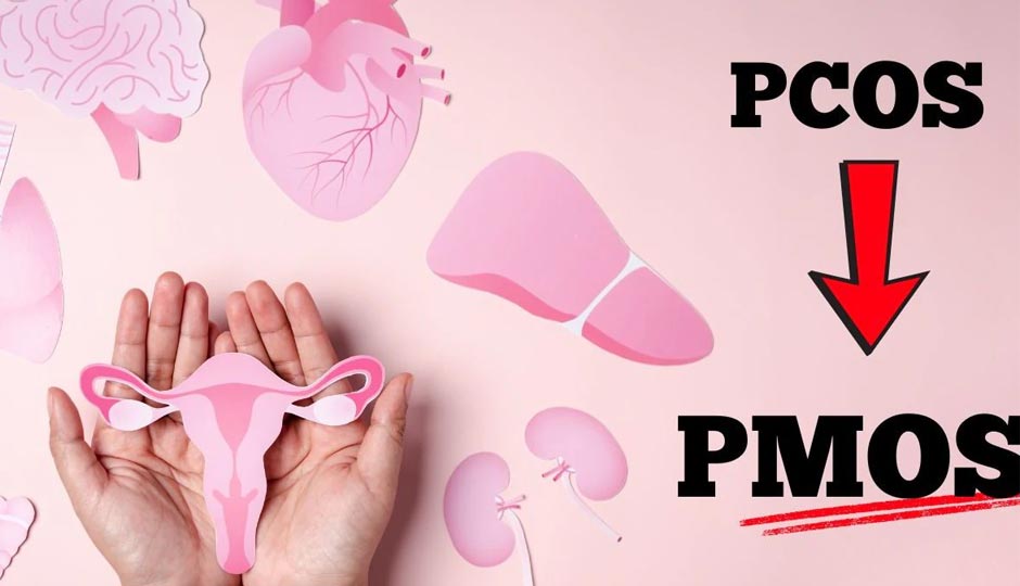 PCOS Renamed To PMOS- What Has Changed