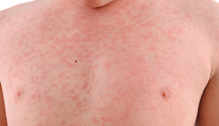 harmful effects to eating too many peanuts,peanuts,side effects of peanuts,Health tips,fitness tips