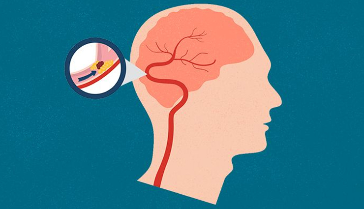 pears,health benefits of pears,Health tips,fitness tips