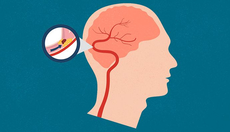 health benefits of eating pears,pears and health benefits,nutritional benefits of pears,eating pears for health,pear health benefits list,benefits of pears for your health,pears nutrition benefits,why eat pears for health,antioxidants in pears,vitamins in pears,minerals in pears,dietary fiber in pears,phytonutrients in pears,digestive health benefits of pears,cardiovascular benefits of pears,weight management with pears,skin benefits of pears,immune-boosting properties of pears