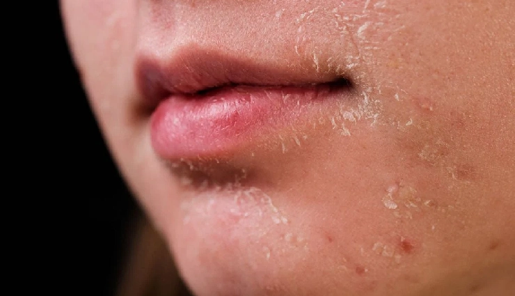 aloe vera for sunburn,sunburn relief,natural sunburn remedy,soothe sun-damaged skin,aloe vera benefits,summer skincare,sunburn treatment at home,cooling gel for burns,sun care tips,aloe vera healing properties