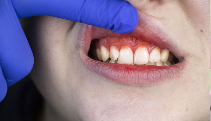 pregnancy symptoms,pregnancy care tips,pregnancy care,pregnant,Health,Health tips