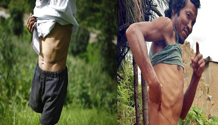 यहां के लोग जीते है सिर्फ एक किडनी के सहारे, इससे जुड़ा राज आपको डरा सकता है people live with one kidney,nepal