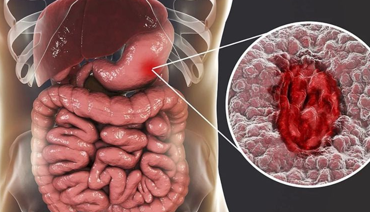 pumpkin and immune system,pumpkin antioxidant properties,pumpkin for digestive health,pumpkin recipes for weight loss,pumpkin nutrients and vitamins,pumpkin role in skin health,pumpkin seed oil benefits,pumpkin impact on blood sugar levels,pumpkin anti-inflammatory properties,pumpkin and bone health,pumpkin in a balanced diet,pumpkin role in reducing cholesterol,pumpkin and mental health,pumpkin in natural remedies,pumpkin impact on metabolism