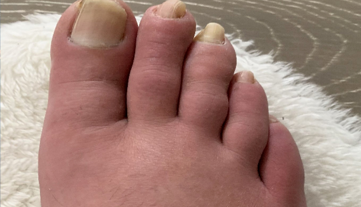 tobacco and cardiovascular diseases,deadly connection between tobacco and cardiovascular health,smoking and heart diseases,tobacco use and cardiovascular risks,effects of smoking on the heart,smoking-related cardiovascular conditions,tobacco addiction and heart health,link between tobacco and heart diseases,smoking cessation for cardiovascular wellness,preventing heart diseases caused by tobacco