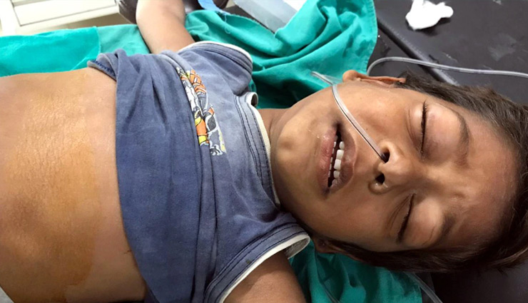 rajasthan,kota,doctor,weird news,3 foot long lumps,weird news