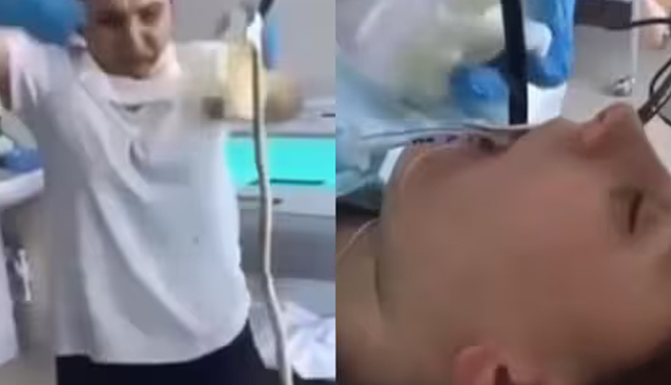 गहरी नींद में सो रही महिला के मुंह के रास्ते पेट तक पहुंचा सांप, डॉक्टर ने ऐसे निकाला, देखें वीडियो
