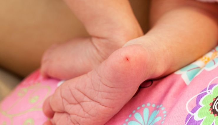 rare diseases in newborns,common diseases in newborns,genetic disorders in newborns,metabolic disorders in newborns,congenital anomalies in newborns,down syndrome in newborns,turner syndrome in newborns,fragile x syndrome in newborns,tay-sachs syndrome in newborns,phenylketonuria (pku) in newborns,orphan diseases in newborns,newborn health disorders,genetic conditions in infants,metabolic diseases in infants,rare congenital diseases in babies