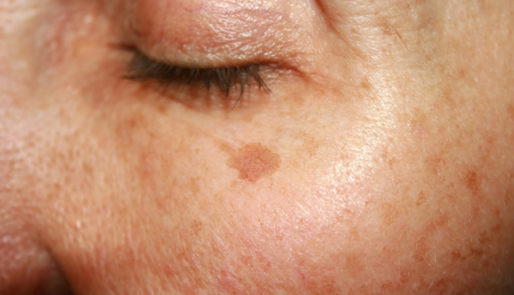 guava leaves benefits,guava leaves tea,guava leaves for hair growth,guava leaves for infection,guava leaves tea side effects,guava leaves and fertility,guava leaves for hair loss,guava leaves and menstruation,guava leaves and pregnancy,guava leaves and fertility in woman,the guava leaves benefits,the guava leaves for hair,guava leaves benefits and side effects,guava leaves benefits for hair,guava leaves benefits for skin,guava leaves boiled water benefits,guava leaves benefits for diabetes,guava leaves contains,guava leaves clean womb,guava leaves diabetes,guava leaves dried,guava leaves disadvantages,guava leaves during pregnancy,guava leaves extract benefits,guava leaves for skin,guava leaves for diabetes,guava leaves for toothache,guava leaves for grey hair,guava leaves good for,guava leaves good for diabetes,guava leaves good for hair,guava leaves ginger and lemon,guava leaves good for kidney,guava leaves health benefits,guava leaves hair,guava leaves hair growth,guava leaves health benefits and side effects,guava leaves hair mask,guava leaves juice,guava leaves juice benefits,guava leaves juice for hair,guava leaves juice health benefits,guava leaves juice for hair growth,guava leaves juice for weight loss,guava leaves juice for diabetes,guava leaves juice important benefits,guava leaves ke fayde,guava leaves kidney,guava leaves lose weight