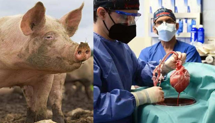 यहां शख्स को लगा दिया गया सूअर का दिल! फिर हुआ चमत्कार 