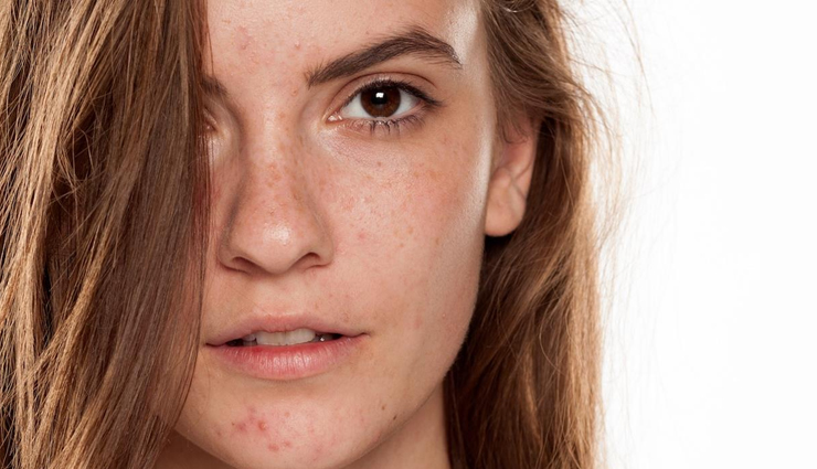 vitamin e oil,vitamin e oil benefits,vitamin e oil for skin,vitamin e oil for skin care,skin care tips,beauty tips,beauty hacks