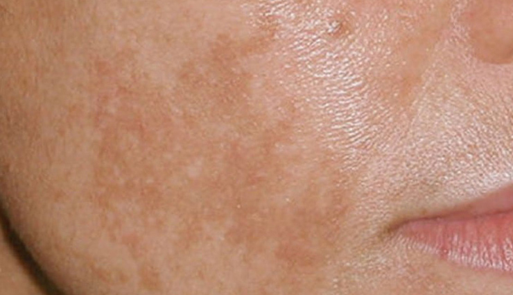 त्वचा के लिए प्रदूषण क्यों है खतरनाक और बचाव कैसे करें? pollution effects on skin,skin damage from pollution,how to protect skin from pollution,pollution and skin health,skin care for pollution protection,best ways to protect skin from pollution,skin protection tips,prevent skin damage from pollution,pollution skincare routine,how pollution harms skin