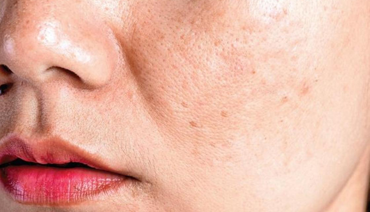 almond oil for skin,benefits of almond oil,almond oil skin care,skin care treatment with almond oil,almond oil beauty hacks,beauty,beauty tips