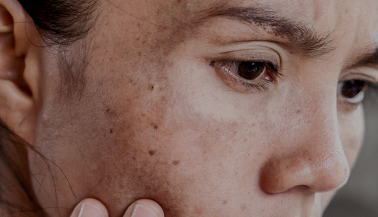 rose water,rose water for skin,skin care tips,rose water beauty secretes,rose water for skin care,beauty tips