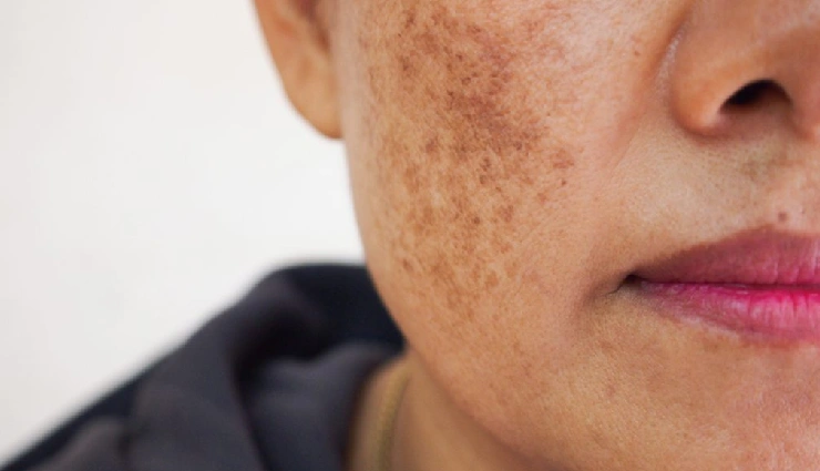 snail gel benefits,snail mucin skincare,korean beauty products,snail secretion filtrate,anti-aging skincare,natural skin healing,hydrating face gel,treat acne naturally,snail cream for wrinkles,k-beauty snail serum,snail gel for dark spots,lightweight moisturizer