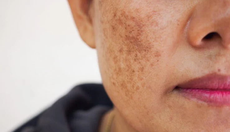 turmeric for skin,benefits of turmeric for face,turmeric face mask,natural skincare remedies,turmeric for acne,turmeric for glowing skin,turmeric anti-aging benefits,homemade turmeric beauty tips,turmeric for pigmentation,ayurvedic skincare turmeric