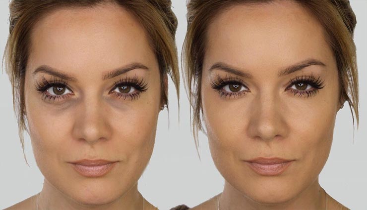 beauty tips,beauty tips in hindi,home remedies,remove pigmentation spots,skincare tips