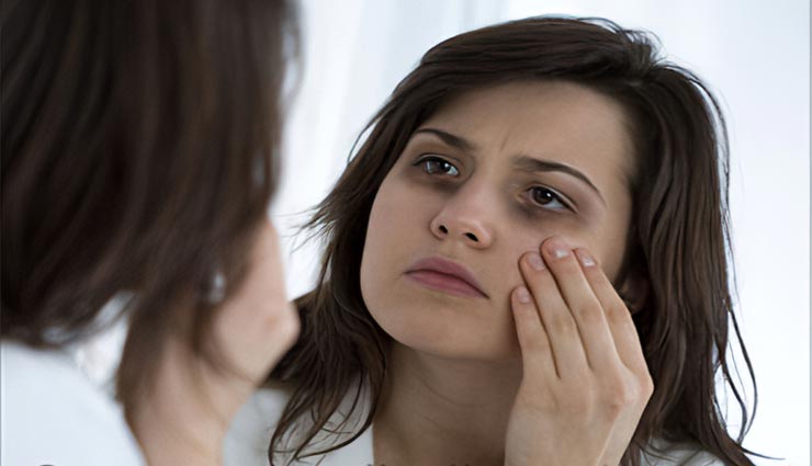 इन घरेलू नुस्खों से दूर करें आंखों के नीचे हुए पिगमेंटेशन स्पॉट्स, छीनते हैं खूबसूरती