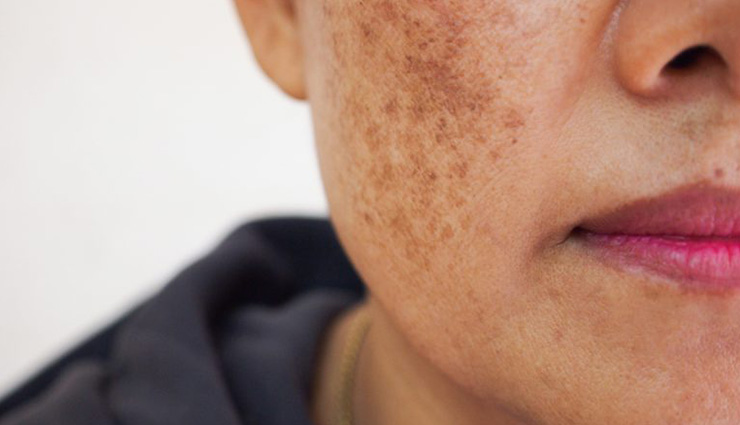 skin pcommon skin problems home remedies,home remedies for skin issues,most common skin problems,natural solutions for skin problems,home remedies for acne,home remedies for eczema,treating skin problems at home,diy skin treatments,natural skin care tips,common skin conditions home remediesroblems