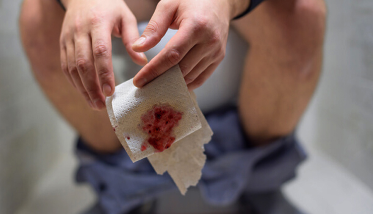 momos overconsumption effects,excessive momos eating side effects,risks of consuming too many momos,momos overindulgence consequences,health risks of eating too many momos,excess momos consumption effects,dangers of overeating momos,momos overdose impact,momos overconsumption risks,excessive momos intake effects