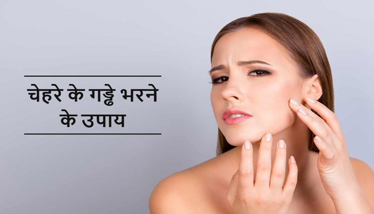 पिंपल्स से बने गड्ढे बिगाड़ रहे स्किन की हालत, इन 5 घरेलू नुस्खों से पाएं सुंदरता