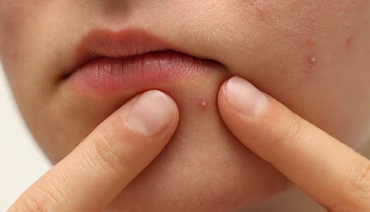 tomato beauty benefits,tomato for skin,tomato for hair,diy tomato skincare,tomato face mask,tomato for acne,tomato for dandruff,tomato hair rinse,natural beauty remedies,lycopene skincare,tomato antioxidants