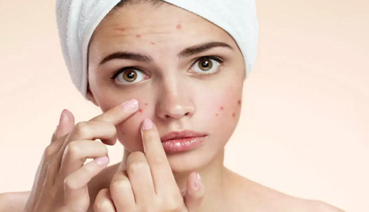 apple cider vinegar,apple cider vinegar for skin,apple cider vinegar for skin care,apple cider vinegar for skin care tips,skin care,skin care tips,beauty tips,beauty