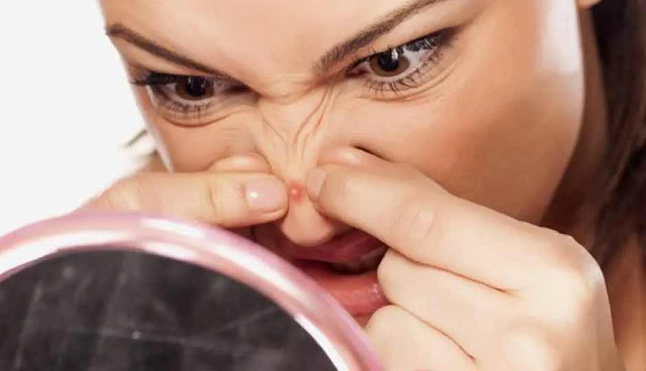 10 Home Remedies to Treat Pimples on the Nose