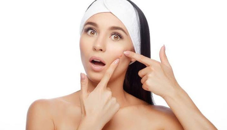 pimple redness,remedies to reduce pimple redness,home remedies,skin care tips,beauty tips