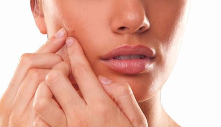 pimple redness,remedies to reduce pimple redness,home remedies,skin care tips,beauty tips