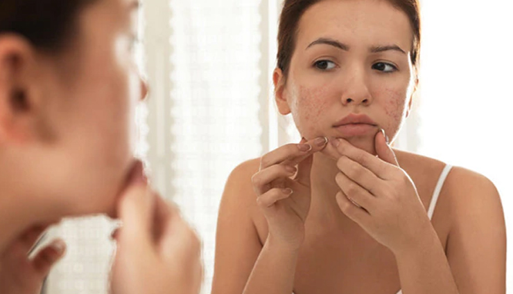 tips to get flawless skin naturally,beauty tips,beauty hacks