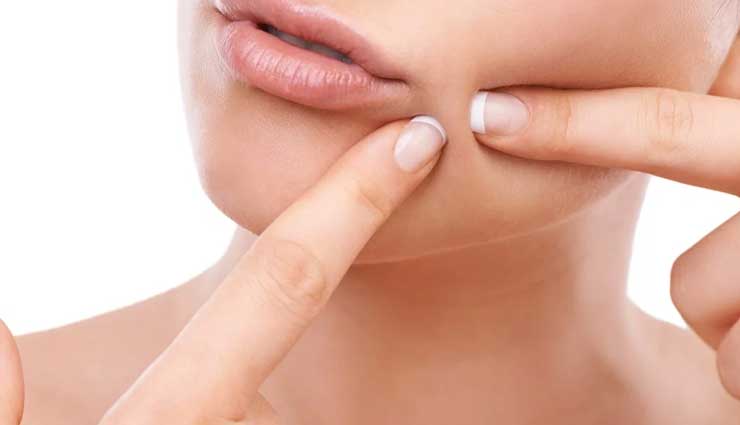 ways to treat pimples,natural tips to treat pimples,pimple care tips,skin care tips,beauty tips