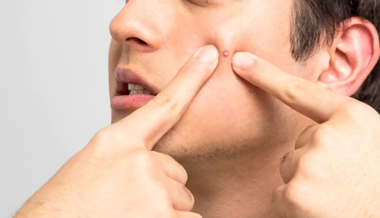 effective home remedies to treat pimples,ways to treat pimples,skin care tips,beauty tips,home remedies