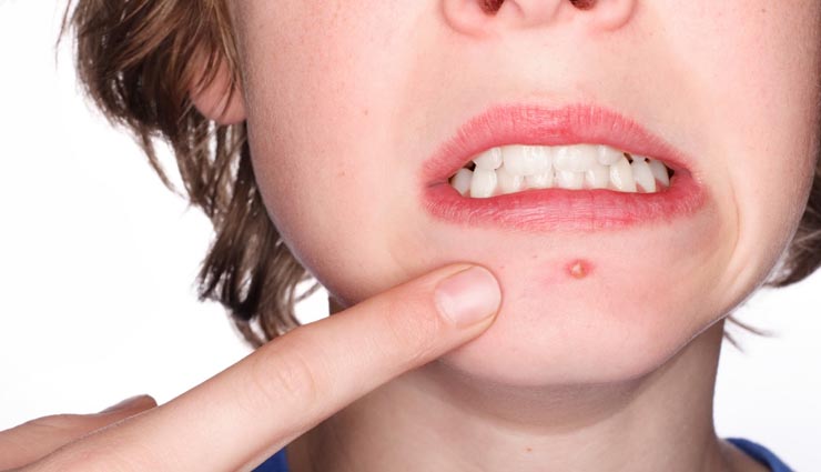 healthy benefits of kaloonji,health tips in hindi,kaloonji ke gunkari fayde