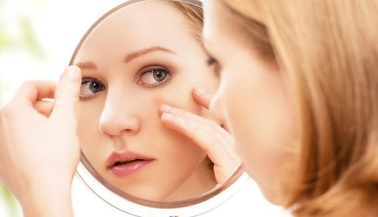 tips to remove pimples,beauty tips,acne,simple beauty tips ,मुहासों,घरेलू ,ब्यूटी टिप्स