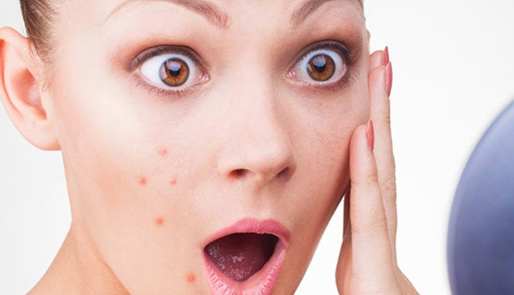 multani mitti for skin,multani mitti for hair,multani mitti benefits,multani mitti beauty benefits,skin care tips,hair care tips,beauty tips,skin problem,acne problem,glemishes,skin and hair care tips