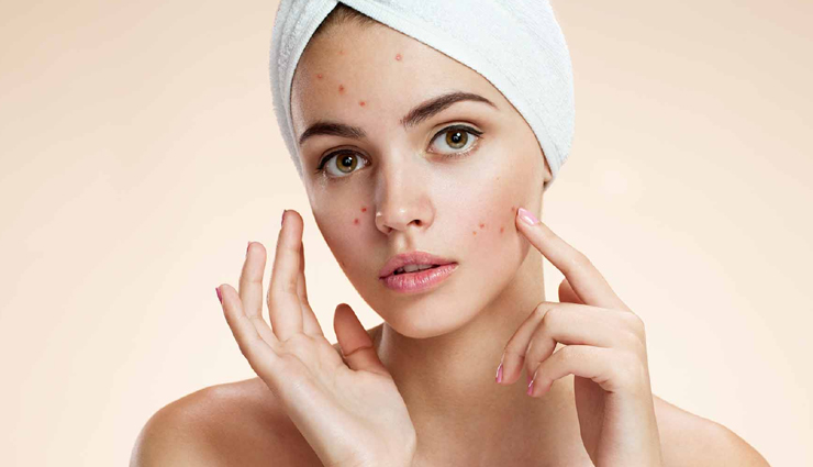 neem benefits for hair and skin,winter hair and skin care with neem,neem oil benefits for winter skincare,neem for winter hair care routine,using neem for winter skin health,neem remedies for winter skin problems,neem for dry skin and hair in winter,winter skincare using neem products,neem leaves benefits for winter beauty,neem extract for winter hair and skin care