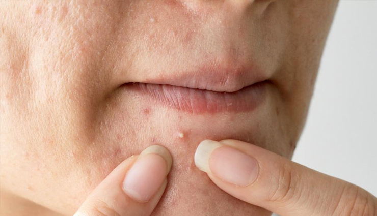 apple cider vinegar health benefits,benefits of consuming apple cider vinegar,health advantages of apple cider vinegar,apple cider vinegar benefits for the body,why apple cider vinegar is beneficial for health,apple cider vinegar advantages,uses and benefits of apple cider vinegar,health perks of apple cider vinegar consumption,apple cider vinegar for wellness,apple cider vinegar and its health effects,apple cider vinegar benefits for the body,apple cider vinegar advantages for health,why apple cider vinegar is good for you,apple cider vinegar benefits and uses,apple cider vinegar properties and benefits