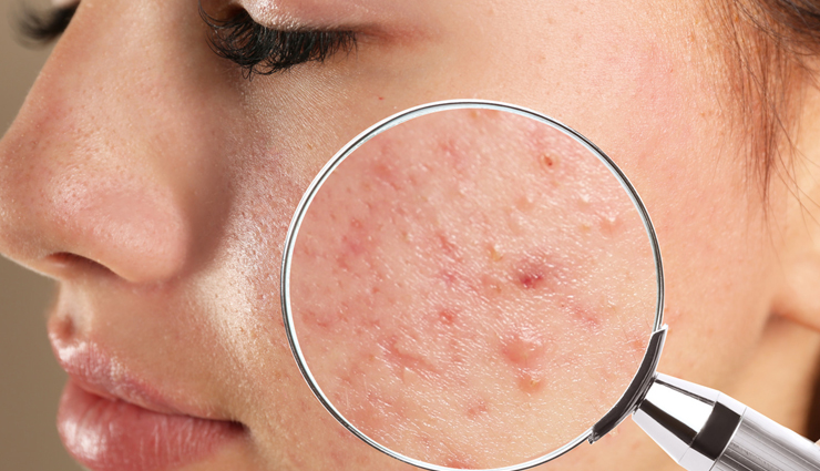 sandalwood oil benefits for skin,skincare benefits of sandalwood oil,sandalwood oil for acne treatment,anti-inflammatory properties of sandalwood oil,astringent effects of sandalwood oil,moisturizing properties of sandalwood oil,antioxidant benefits of sandalwood oil for anti-aging,sandalwood oil for even skin tone,sandalwood oil for radiant skin,calming aroma of sandalwood oil