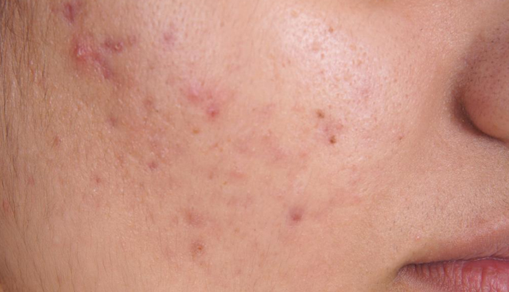 mogra beauty benefits,mogra flower benefits for skin,mogra oil benefits for hair,mogra essential oil benefits,mogra fragrance benefits,mogra skincare advantages,mogra in beauty routines,mogra extract benefits for beauty,mogra flower uses in cosmetics,mogra floral beauty benefits,mogra beauty secrets,mogra flower skincare benefits,mogra perfume benefits,mogra petals benefits for skin,mogra scent advantages,mogra aromatherapy benefits,mogra flower essence benefits,mogra extract skincare benefits,mogra floral water benefits,mogra natural beauty remedies