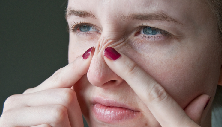 5 Home Remedies to Get of Pimples From Nose