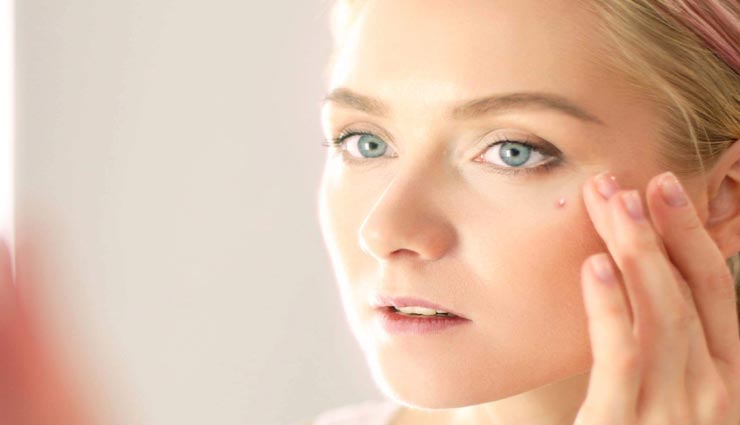 ये 3 घरेलू फेसपैक दूर करेंगे चहरे से पिंपल्स, मिलेगी बेदाग़ त्वचा