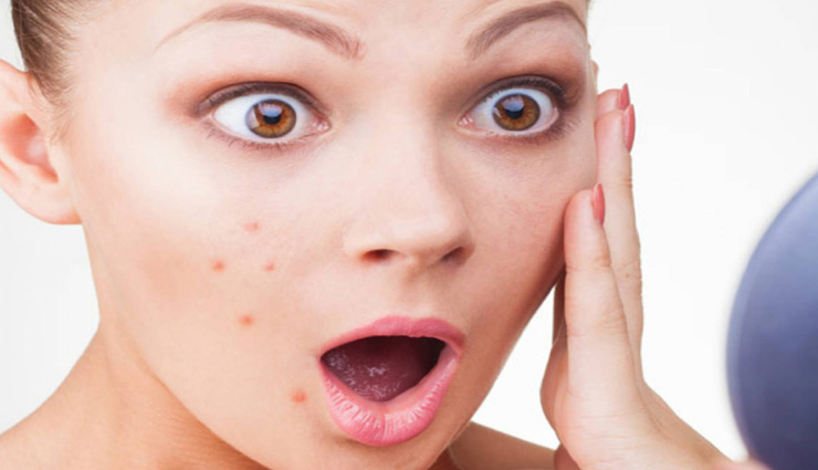 beauty tips,beauty tips in hindi,beauty mistakes,pimple on face
