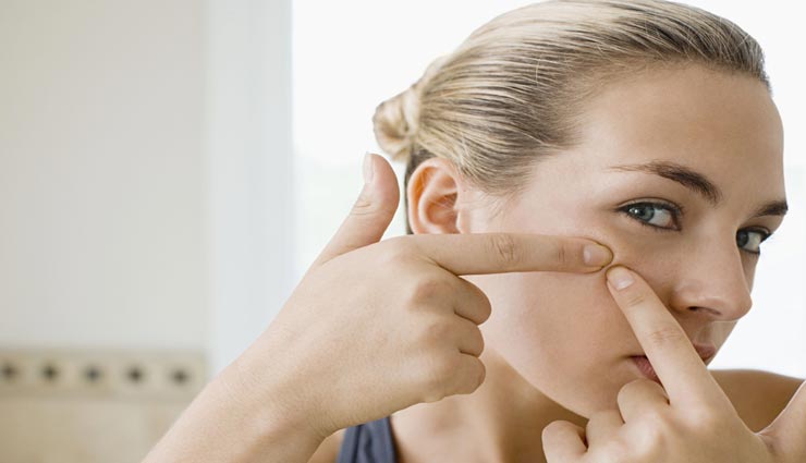 ये 4 फूड्स बन रहे पिंपल्स का कारण, सोच समझकर करें इनका सेवन