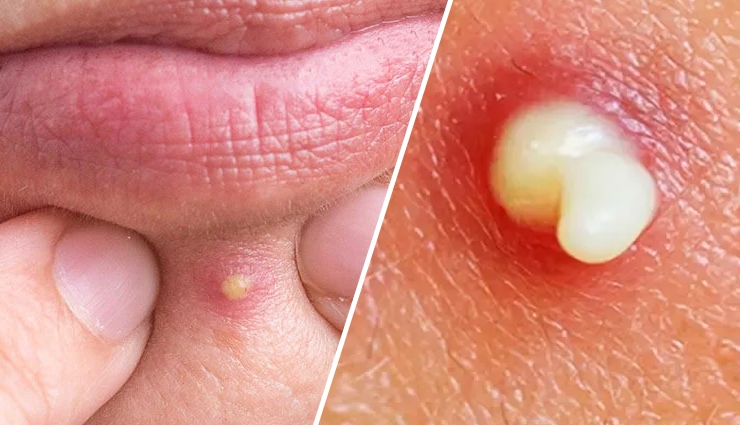 beauty mistakes,common beauty mistakes,beauty blunders,skincare mistakes,hair care mistakes,makeup mistakes,beauty habits to avoid,beauty tips,skincare routine,hair damage prevention,makeup removal tips,heat styling damage,healthy beauty habits,flawless skin tips,beauty dos and donts.