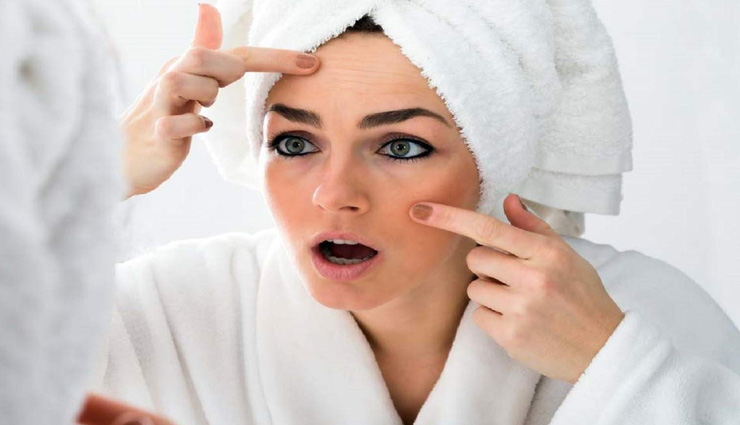 मुंहासे होने पर कहीं आप भी तो नहीं करती ये गलतियां