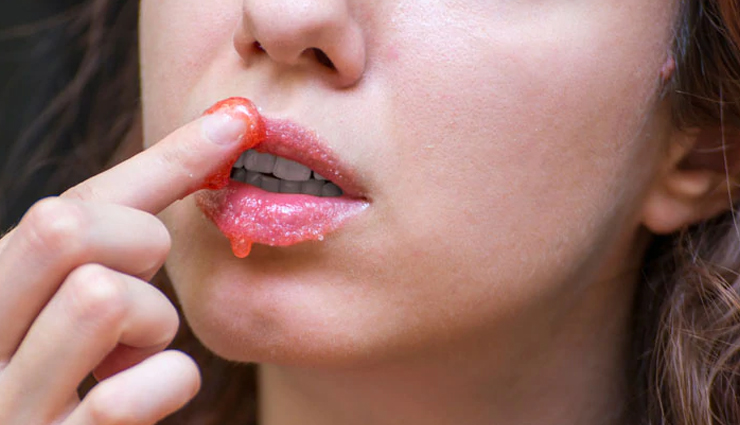 4 Must Try Home Remedies To Get Pink Lips